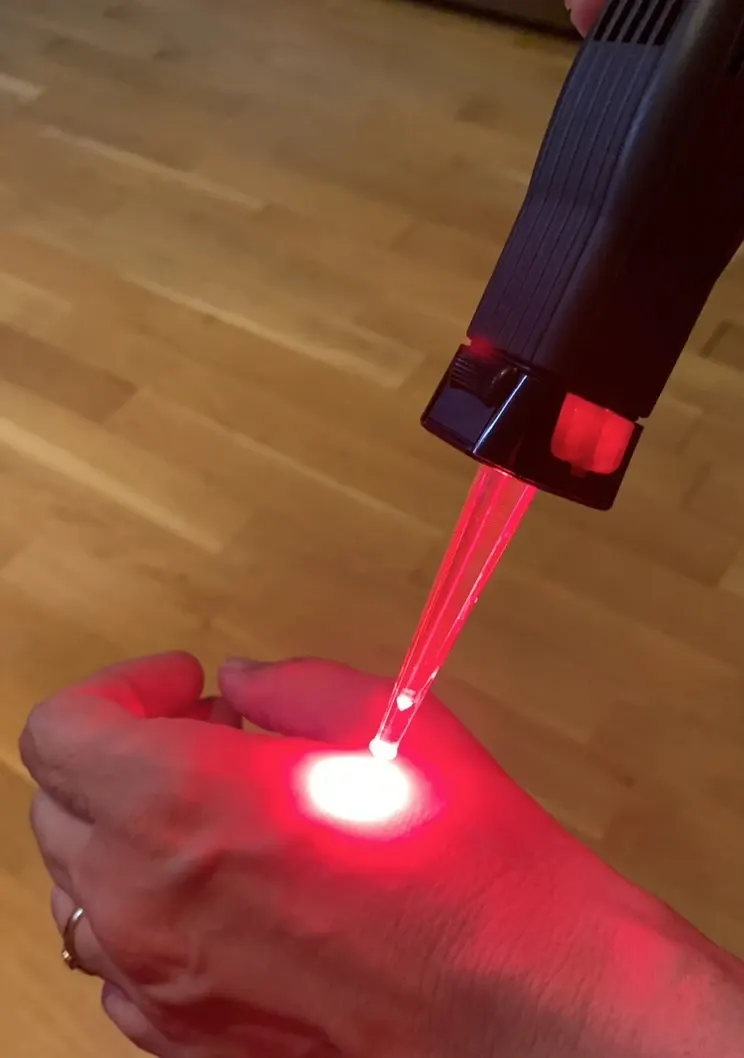 Terapia con Láser Frío
